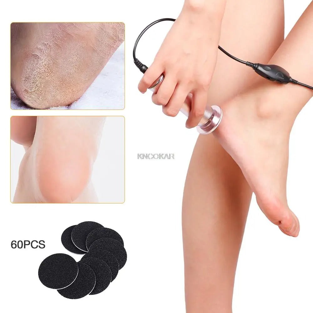 ¡Transforma Tus Pies con el Removedor de Callos Eléctrico!